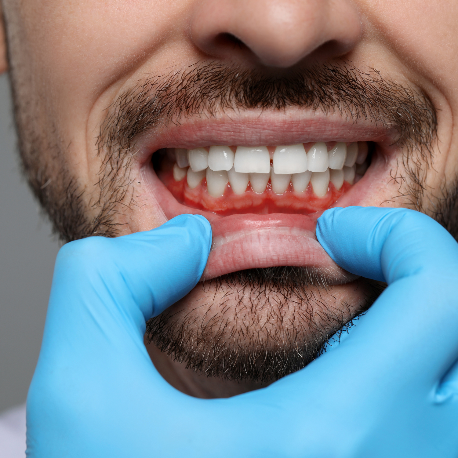 Oral & Dental Care
