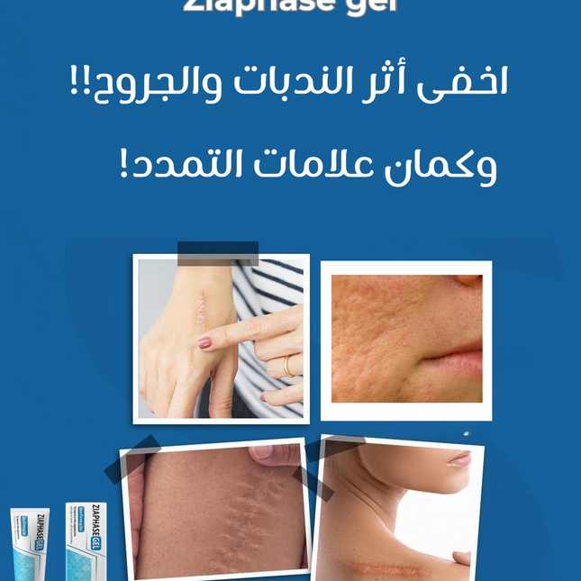 Ziaphase Anti-Scar Gel – 50 g  – Special Offer (6 Packs)