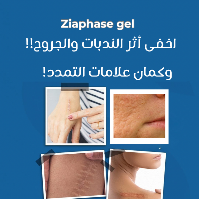 Ziaphase Anti-Scar Gel – 50 g  – Special Offer (4 Packs)